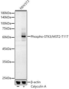 Phospho-STK3/MST2-T117 Rabbit Polyclonal Antibody