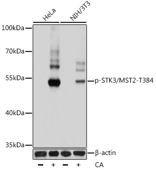 Phospho-STK3/MST2-T384 Rabbit Polyclonal Antibody