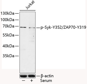 Phospho-Syk-Y352/ZAP70-Y319 Rabbit Polyclonal Antibody