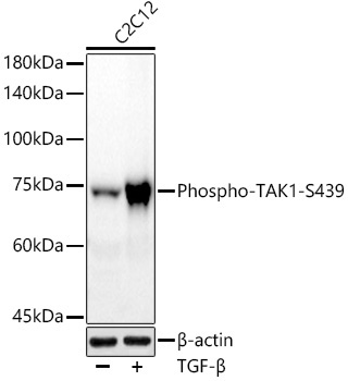 Phospho-TAK1-S439 Rabbit Monoclonal Antibody