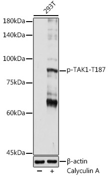 Phospho-TAK1-T187 Rabbit Polyclonal Antibody