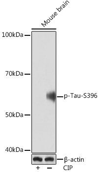 Phospho-Tau-S396 Rabbit Monoclonal Antibody