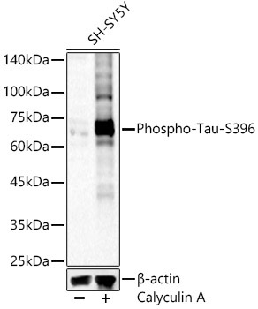 Phospho-Tau-S396 Rabbit Polyclonal Antibody