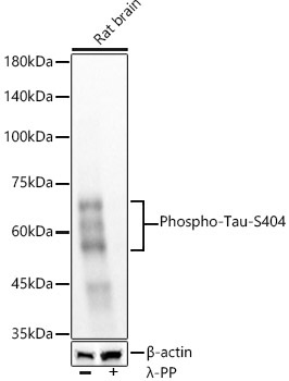 Phospho-Tau-S404 Rabbit Monoclonal Antibody