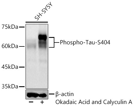 Phospho-Tau-S404 Rabbit Monoclonal Antibody - Image 3