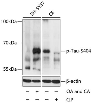 Phospho-Tau-S404 Rabbit Polyclonal Antibody