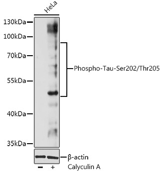 Phospho-Tau-Ser202/Thr205 Rabbit Polyclonal Antibody