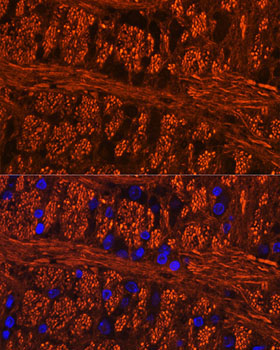 Phospho-Tau-Ser404 Rabbit Polyclonal Antibody