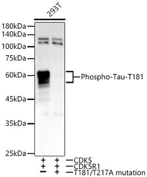 Phospho-Tau-T181 Rabbit Monoclonal Antibody