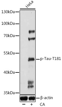 Phospho-Tau-T181 Rabbit Polyclonal Antibody
