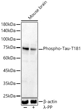 Phospho-Tau-T181 Rabbit Polyclonal Antibody