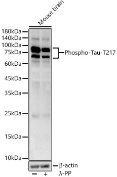 Phospho-Tau-T217 Rabbit Polyclonal Antibody