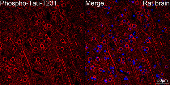 Phospho-Tau-T231 Rabbit Monoclonal Antibody