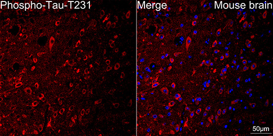 Phospho-Tau-T231 Rabbit Monoclonal Antibody - Image 2