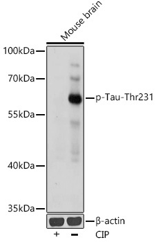 Phospho-Tau-T231 Rabbit Polyclonal Antibody