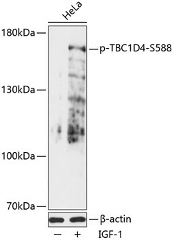 Phospho-TBC1D4-S588 Rabbit Polyclonal Antibody