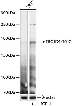 Phospho-TBC1D4-T642 Rabbit Polyclonal Antibody