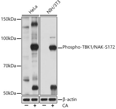 Phospho-TBK1/NAK-S172 Rabbit Monoclonal Antibody