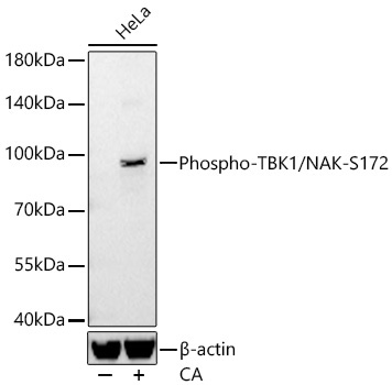 Phospho-TBK1/NAK-S172 Rabbit Monoclonal Antibody