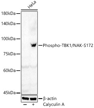 Phospho-TBK1/NAK-S172 Rabbit Polyclonal Antibody