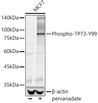Phospho-TP73-Y99 Rabbit Polyclonal Antibody