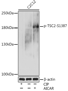 Phospho-TSC2-S1387 Rabbit Polyclonal Antibody