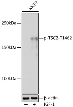 Phospho-TSC2-T1462 Rabbit Polyclonal Antibody