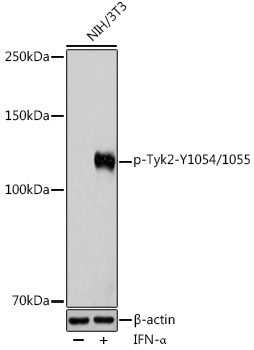 Phospho-Tyk2-Y1054/1055 Rabbit Polyclonal Antibody