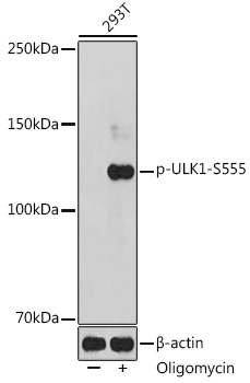 Phospho-ULK1-S555 Rabbit Polyclonal Antibody