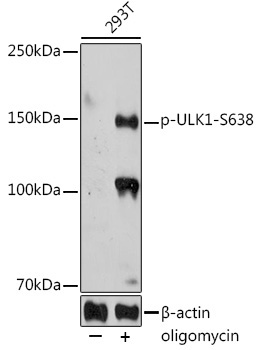 Phospho-ULK1-S638 Rabbit Polyclonal Antibody