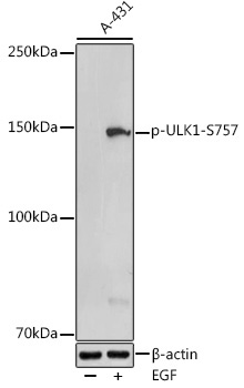Phospho-ULK1-S757 Rabbit Polyclonal Antibody
