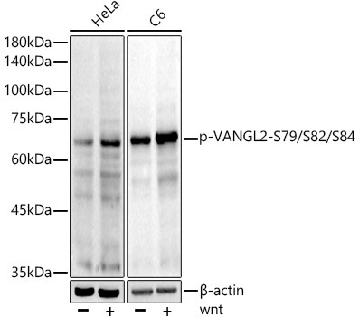 Phospho-VANGL2-S79/S82/S84 Rabbit Monoclonal Antibody