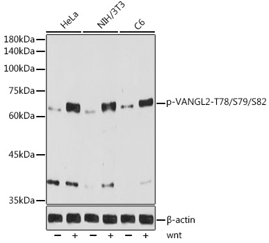 Phospho-VANGL2-T78/S79/S82 Rabbit Monoclonal Antibody