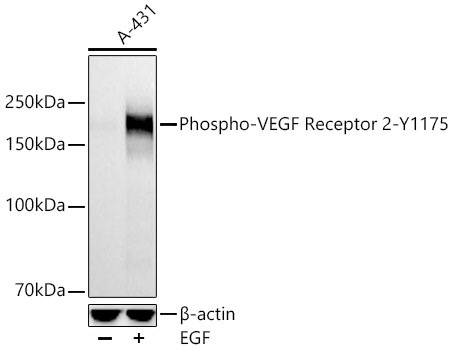 Phospho-VEGF Receptor 2-Y1175 Rabbit Monoclonal Antibody