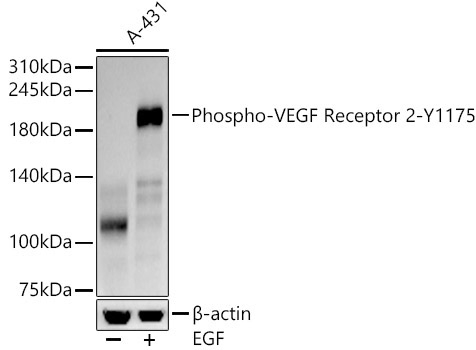 Phospho-VEGF Receptor 2-Y1175 Rabbit Monoclonal Antibody