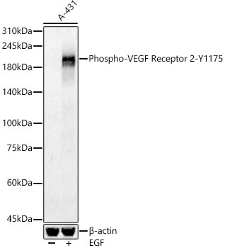 Phospho-VEGF Receptor 2-Y1175 Rabbit Polyclonal Antibody