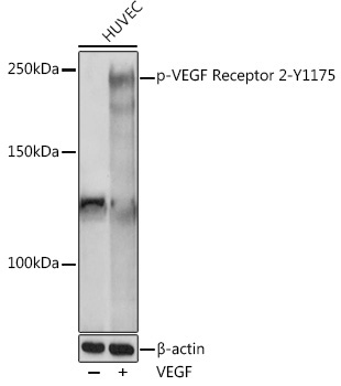 Phospho-VEGF Receptor 2-Y1175 Rabbit Polyclonal Antibody