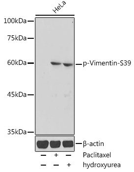 Phospho-Vimentin-S39 Rabbit Polyclonal Antibody