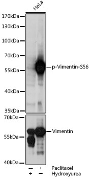 Phospho-Vimentin-S56 Rabbit Polyclonal Antibody