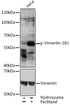 Phospho-Vimentin-S83 Rabbit Polyclonal Antibody