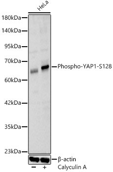 Phospho-YAP1-S128 Rabbit Polyclonal Antibody