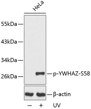 Phospho-YWHAZ-S58 Rabbit Polyclonal Antibody