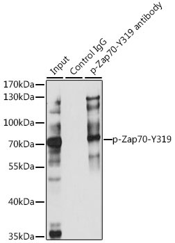 Phospho-ZAP70-Y319 Rabbit Polyclonal Antibody