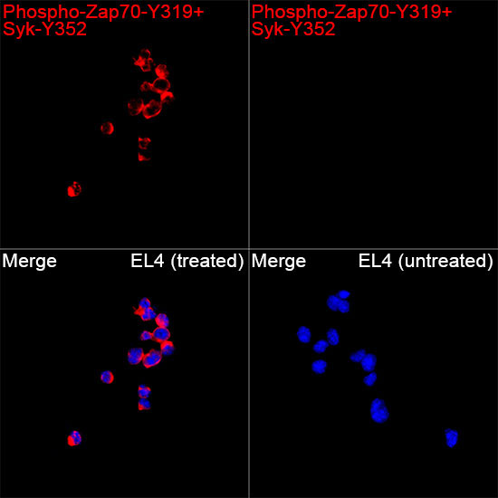 Phospho-Zap70-Y319+Syk-Y352 Rabbit Polyclonal Antibody