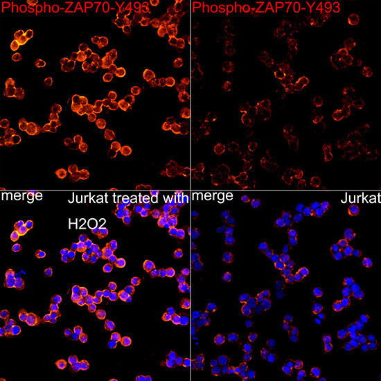 Phospho-ZAP70-Y493 Rabbit Monoclonal Antibody