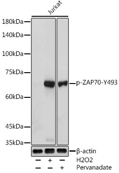 Phospho-ZAP70-Y493 Rabbit Polyclonal Antibody