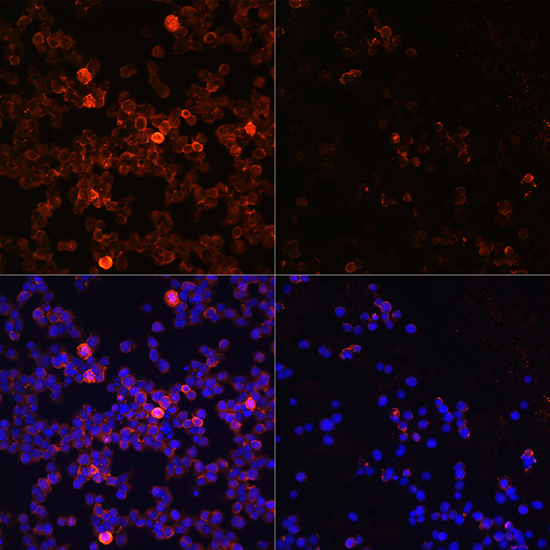 Phospho-ZAP70-Y493 Rabbit Polyclonal Antibody - Image 2