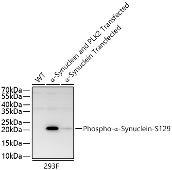 Phospho-Alpha-Synuclein-S129 Rabbit Polyclonal Antibody