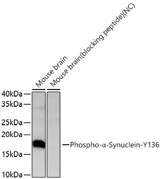 Phospho-Alpha-Synuclein-Y136 Rabbit Polyclonal Antibody