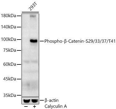 Phospho-Beta-Catenin-S29/33/37/T41 Rabbit Polyclonal Antibody